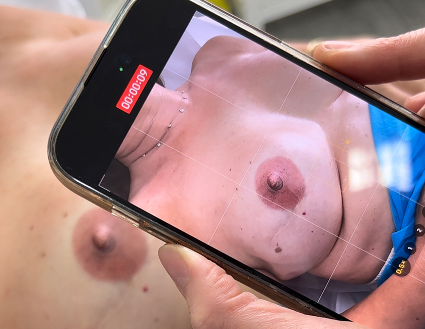 3D Areola tetoválás